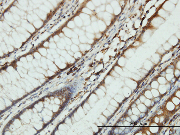 Immunoperoxidase of monoclonal antibody to SARS on formalin-fixed paraffin-embedded human colon tissue. [antibody concentration 3 ug/ml].