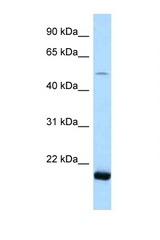 SARS2 / Seryl-tRNA Synthetase 2 antibody LS-C145895 Western blot of 721_B Cell lysate. Antibody concentration 1 ug/ml.