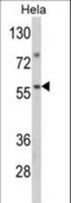 Western blot of SARS2 Antibody in HeLa cell line lysates (35 ug/lane). SARS2 (arrow) was detected using the purified antibody.