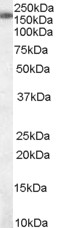 Antibody staining (0.01 ug/ml) of Jurkat cell lysate (RIPA buffer, 30 ug total protein per lane). Primary incubated for 1 hour. Detected by Western blot of chemiluminescence.