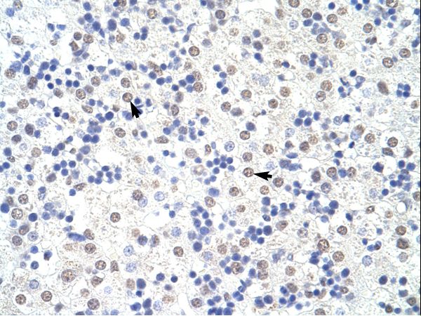 SART3 antibody LS-C31583 was used in IHC to stain formalin-fixed, paraffin-embedded human liver.