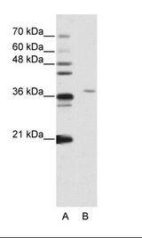 A: Marker, B: Jurkat Cell Lysate