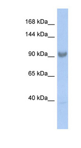 SART3 antibody LS-C109897 Western blot of Fetal Small Intestine lysate.