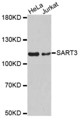 Western blot analysis of extracts of various cell lines, using SART3 antibody.