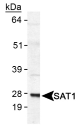 Detection of SAT1 in human SAT1 transfected lysate.