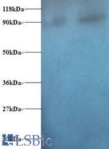 Western blot of Diamine acetyltransferase 1 antibody at 2ug/ml. Lane 1:293T whole cell lysate. Lane 2: EC109 whole cell lysate. Secondary: Goat polyclonal to Rabbit IgG at 1:15000 dilution. Predicted band size: 19 kDa. Observed band size: 90 kDa.