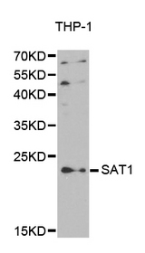Western blot analysis of extracts of various cell lines, using SAT1 antibody.