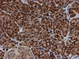 IHC of paraffin-embedded Human pancreas tissue using anti-SAT2 mouse monoclonal antibody.