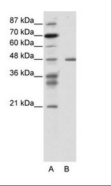 A: Marker, B: Jurkat Cell Lysate