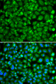 Immunofluorescence blot of MCF7 cell using SAT2 antibody. Blue: DAPI for nuclear staining.