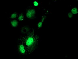 Anti-SAT2 mouse monoclonal antibody immunofluorescent staining of COS7 cells transiently transfected by pCMV6-ENTRY SAT2.