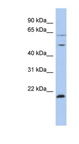PSMC2 antibody LS-C109885 Western blot of OVCAR-3 cell lysate.