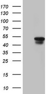 HEK293T cells were transfected with the pCMV6-ENTRY control (Left lane) or pCMV6-ENTRY SAV1 (Right lane) cDNA for 48 hrs and lysed. Equivalent amounts of cell lysates (5 ug per lane) were separated by SDS-PAGE and immunoblotted with anti-SAV1.