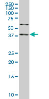 SAV1 monoclonal antibody (M04), clone 3A10. Western blot of SAV1 expression in HeLa NE.