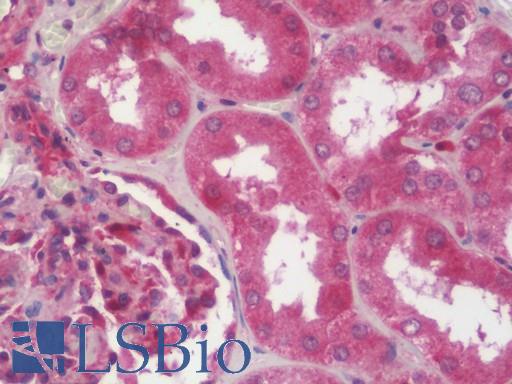 Anti-SAV1 / WW45 antibody IHC staining of human kidney. Immunohistochemistry of formalin-fixed, paraffin-embedded tissue after heat-induced antigen retrieval. Antibody LS-B10422 dilution 1:100.