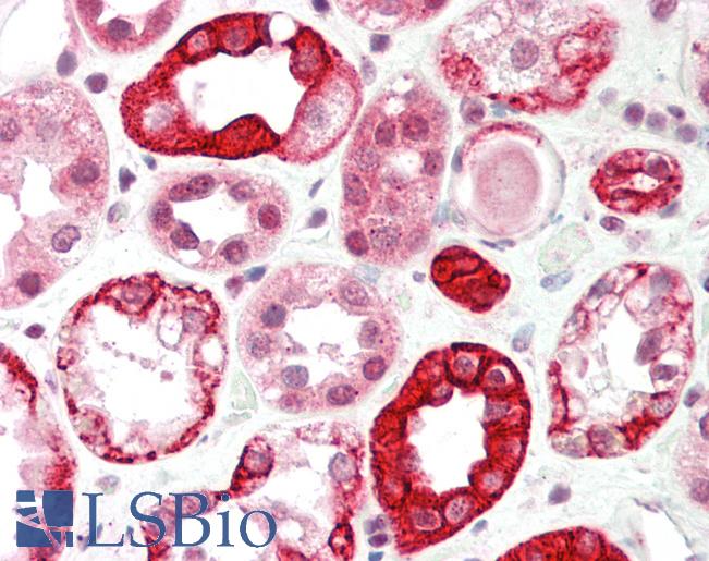 Human Kidney: Formalin-Fixed, Paraffin-Embedded (FFPE)