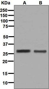 Western blot analysis on (A) 293T and (B) Caco-2 cell lysates using anti-SBDS antibody.