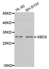 Western blot analysis of extracts of various cell lines, using SBDS antibody.