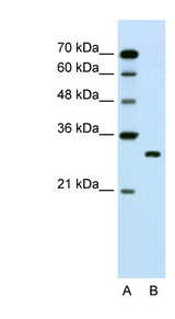 SBDS antibody LS-C40532 Western blot of Jurkat lysate.