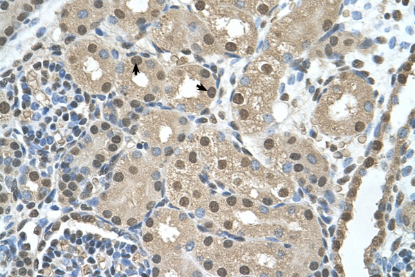 SBDS antibody LS-C40531 IHC of formalin-fixed, paraffin-embedded human Kidney. Positive label: Epithelial cells of renal tubule indicated with arrows. Antibody concentration 4-8 ug/ml. Magnification 400X.