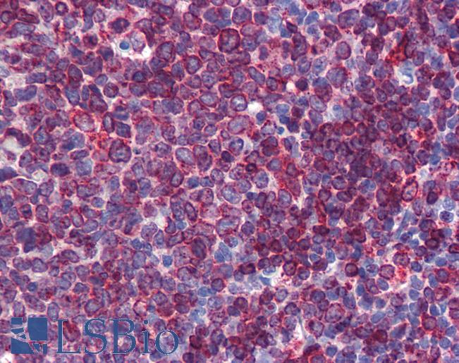 Anti-SC5DL antibody IHC of human tonsil. Immunohistochemistry of formalin-fixed, paraffin-embedded tissue after heat-induced antigen retrieval. Antibody LS-B5785 concentration 5 ug/ml.