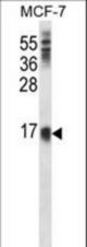 LY6E Antibody western blot of MCF-7 cell line lysates (35 ug/lane). The LY6E antibody detected the LY6E protein (arrow).