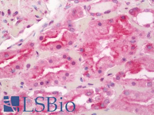 Anti-SCA2 / LY6E antibody IHC staining of human kidney. Immunohistochemistry of formalin-fixed, paraffin-embedded tissue after heat-induced antigen retrieval. Antibody LS-B11371 concentration 20 ug/ml.