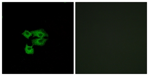 Immunofluorescence of A549 cells, using LY6E Antibody. The picture on the right is treated with the synthesized peptide.