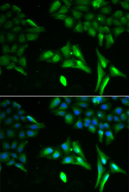 Immunofluorescence blot of U20S cell using ACADS antibody. Blue: DAPI for nuclear staining.