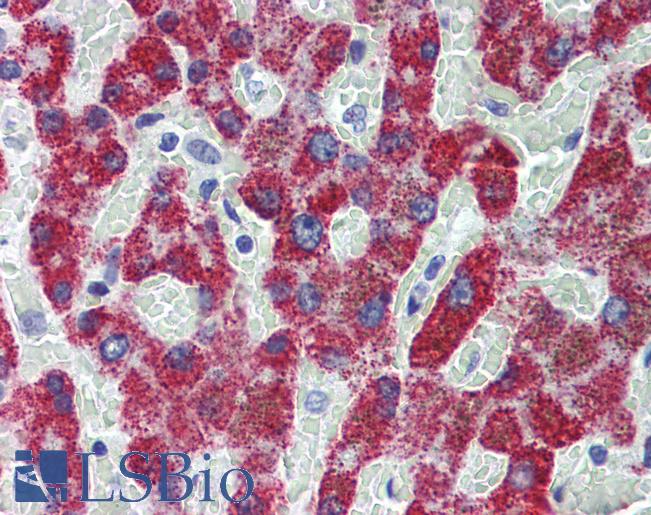 Anti-ACADS antibody IHC of human liver. Immunohistochemistry of formalin-fixed, paraffin-embedded tissue after heat-induced antigen retrieval. Antibody LS-B4087 concentration 10 ug/ml.