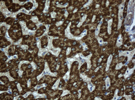 IHC of paraffin-embedded Human liver tissue using anti-ACADS mouse monoclonal antibody.