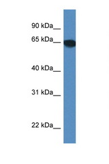 SCARA3 antibody LS-C145215 Western blot of Mouse Brain lysate. Antibody concentration 1 ug/ml.