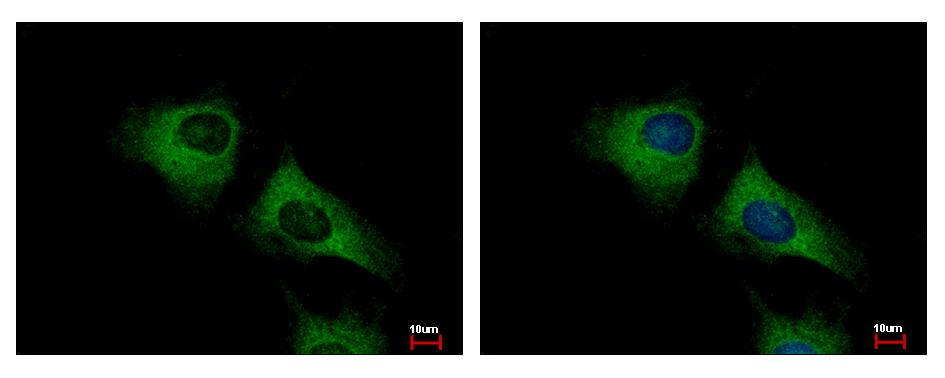 SCARA3 antibody [N2C2], Internal detects SCARA3 protein at cytoplasm by immunofluorescent analysis. HeLa cells were fixed in -20 100% MeOH for 5 min. SCARA3 protein stained by SCARA3 antibody [N2C2], Internal diluted at 1:500. 