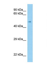 SCARB1 / SR-BI antibody LS-C146242 Western blot of Fetal Kidney lysate. Antibody concentration 1 ug/ml.
