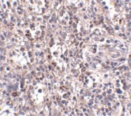Immunohistochemistry of SCARB1 in human spleen tissue with SCARB1 antibody at 2.5 ug/ml.