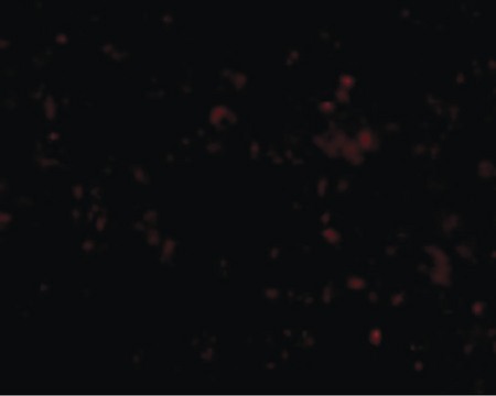 Immunofluorescence of SCARB1 in Human Spleen cells with SCARB1 antibody at 20 ug/ml.