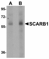 Western blot of SCARB1 in human spleen tissue lysate with SCARB1 antibody at (A) 1 and (B) 2 ug/ml. Below: Immunohistochemistry of SCARB1 in human spleen tissue with SCARB1 antibody at 2.5 ug/ml.