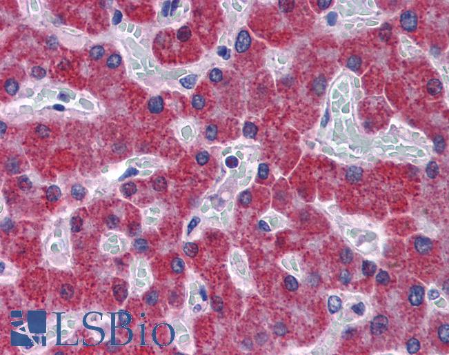 Anti-SCD antibody IHC of human liver. Immunohistochemistry of formalin-fixed, paraffin-embedded tissue after heat-induced antigen retrieval. Antibody LS-B3941 concentration 5 ug/ml.