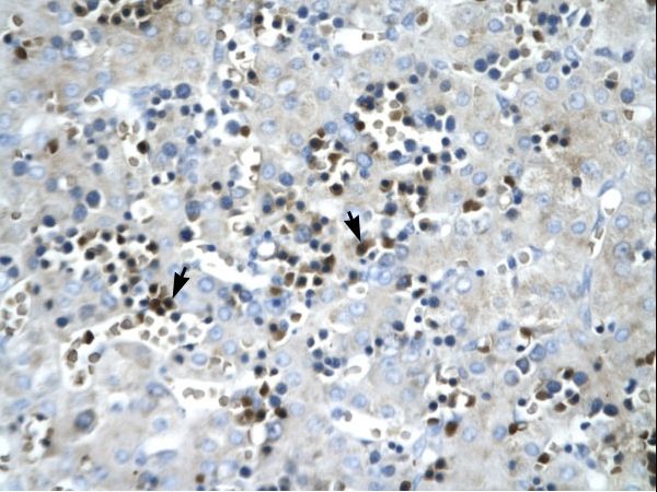 SCD antibody LS-C30865 was used in IHC to stain formalin-fixed, paraffin-embedded human liver.