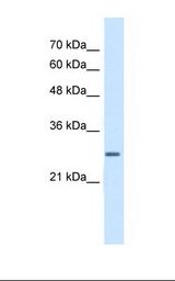 Jurkat cell lysate. Antibody concentration: 5.0 ug/ml. Gel concentration: 12%.