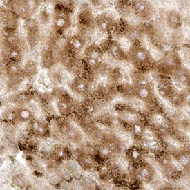 Stathmin-2/STMN2 in Human Liver. Stathmin-2/STMN2 was detected in immersion fixed paraffin-embedded sections of human liver using Mouse Anti-Human Stathmin-2/STMN2 Monoclonal Antibody at 15 ug/ml overnight at 4°C. Tissue was stained using Anti-Mouse HRP-DAB (brown) and counterstained with hematoxylin (blue). Specific staining was localized to hepatocytes.