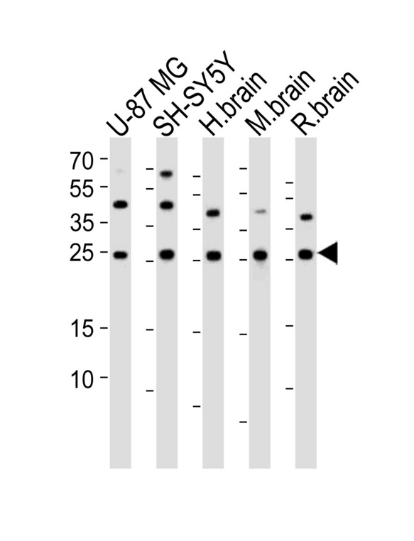 Western blot of lysates from U-87 MG, SH-SY5Y cell line, human brain, mouse brain, rat brain tissue lysate (from left to right) with STMN2 Antibody. Antibody was diluted at 1:1000 at each lane. A goat anti-rabbit IgG H&L (HRP) at 1:10000 dilution was used as the secondary antibody. Lysates at 35 ug per lane.