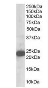 Western analysis (1 ug/ml) of Human Brain lysate (RIPA buffer, 35 ug total protein per lane). Primary incubated for 1 hour. Detected using chemiluminescence.