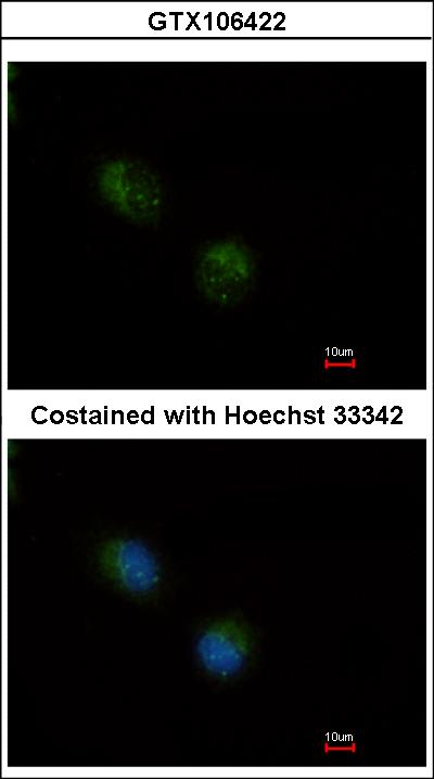 Immunofluorescence of methanol-fixed A549 using STMN2 antibody at 1:500 dilution.