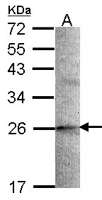 Sample (30 ug of whole cell lysate). A: A549 12% SDS PAGE. SCG10 / STMN2 antibody diluted at 1:1000.