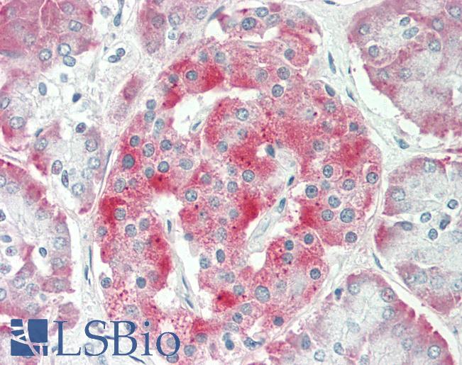 Human Pancreas: Formalin-Fixed, Paraffin-Embedded (FFPE)