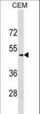 SCG3 Antibody western blot of CEM cell line lysates (35 ug/lane). The SCG3 antibody detected the SCG3 protein (arrow).