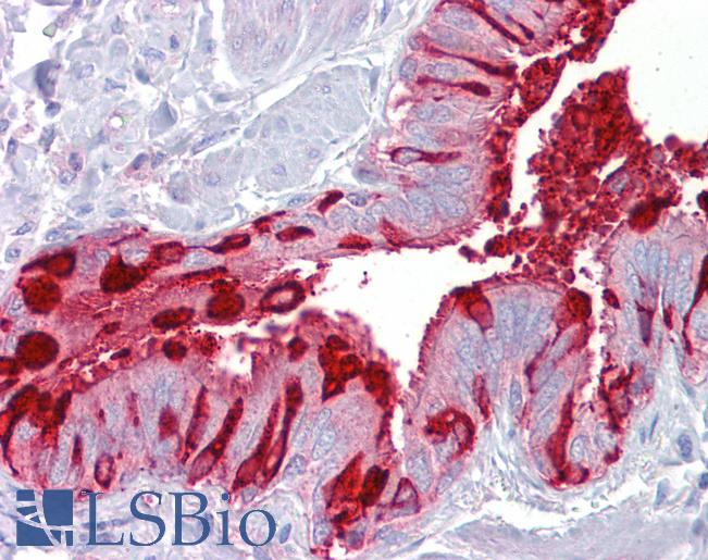 Anti-SCGB1A1 / Uteroglobin antibody IHC of human lung, respiratory epithelium. Immunohistochemistry of formalin-fixed, paraffin-embedded tissue after heat-induced antigen retrieval. Antibody LS-B6822 concentration 5 ug/ml.
