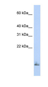 SCGB1A1 / Uteroglobin antibody LS-B6822 Western blot of Fetal Brain lysate.