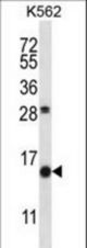 SCGB1D2 Antibody western blot of K562 cell line lysates (35 ug/lane). The SCGB1D2 antibody detected the SCGB1D2 protein (arrow).